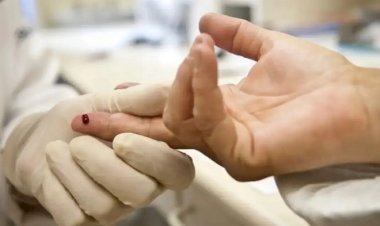 Com 93 casos entre adolescentes, Sesab nega surto de HIV na Bahia