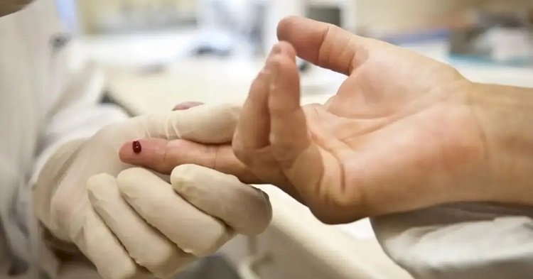 Com 93 casos entre adolescentes, Sesab nega surto de HIV na Bahia